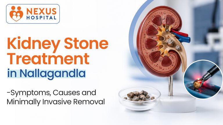Kidney Stone Treatment in Nallagandla