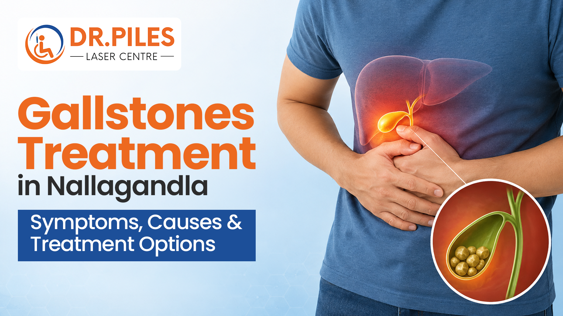 Gallstones Treatment in Nallagandla: Symptoms, Causes & Treatment Options