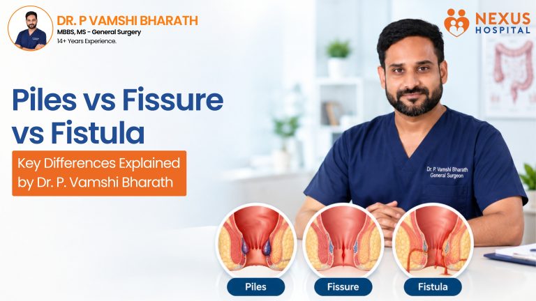 Piles vs Fissure vs Fistula