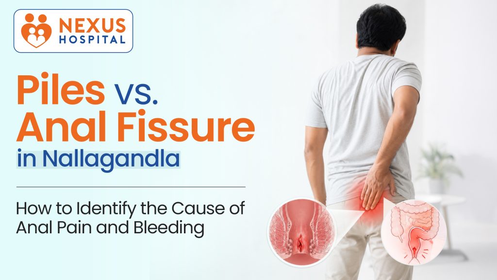 Piles vs. Anal Fissure in Nallagandla